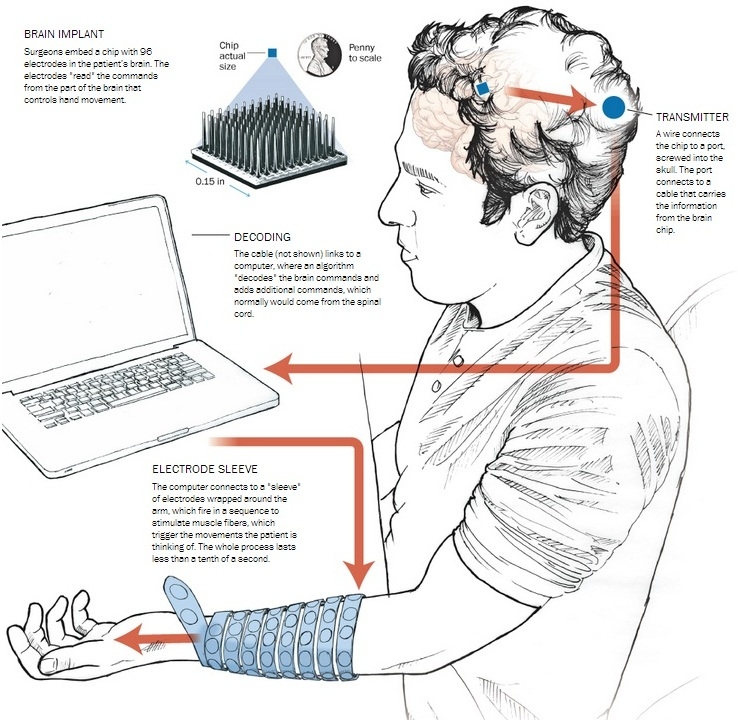 Новая технология позволила парализованному человеку управлять собственной рукой Новая технология позволила парализованному человеку управлять собственной рукой