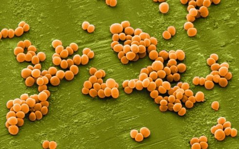 Новый антибиотик способен убивать лекарственно устойчивые бактерии