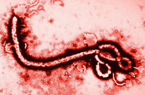 10 причин, по которым Эбола не приведет к концу света