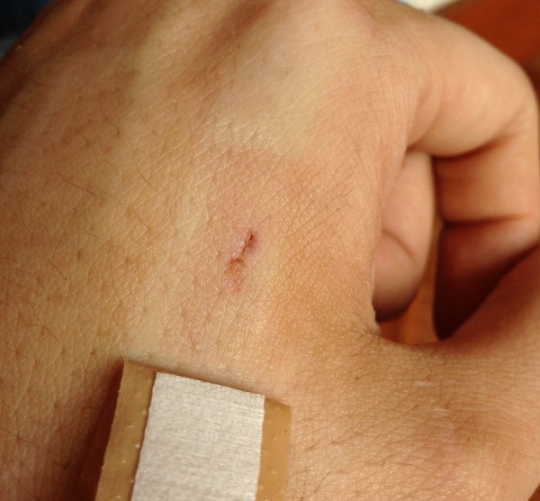 Как я имплантировал RFID себе в руку, а потом еще NFC. Часть 1 - 4