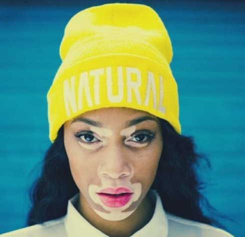 Невероятная американская модель с пигментацией кожи (Фото) - 15 Невероятная американская модель с пигментацией кожи (Фото)