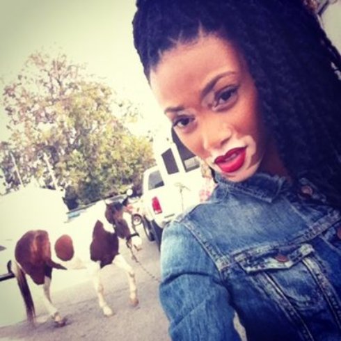 Невероятная американская модель с пигментацией кожи (Фото) - 6 Невероятная американская модель с пигментацией кожи (Фото)