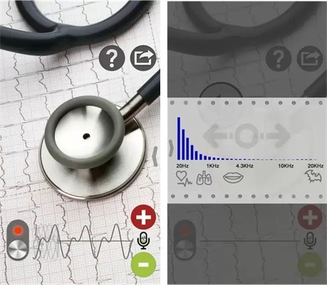 Как умные часы, спортивные трекеры и прочие гаджеты измеряют пульс? Часть 2 - 15 Как умные часы, спортивные трекеры и прочие гаджеты измеряют пульс? Часть 2 - 15