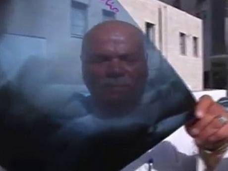 Гинеколог оставил телефон в животе пациентки - 1 image