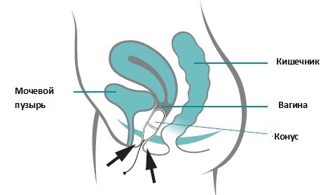 Умные вагинальные шарики Gball: тестируем, анализируем, общаемся с гинекологом и вспоминаем Арнольда Кегеля - 6
