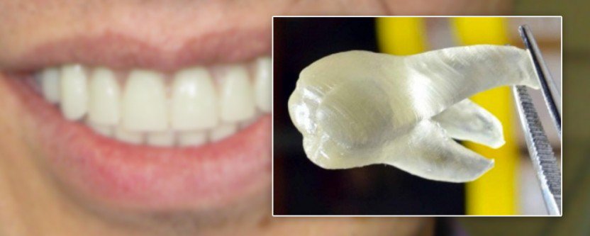 Новый материал для зубных имплантатов убивает 99% вредоносных бактерий - 1
