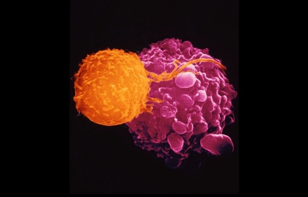 Первый генетически модифицированный вирус одобрен для лечения рака - 1