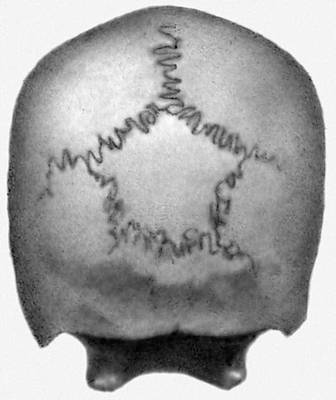 История изучения мозга от Древнего Египта до начала XX века - 61