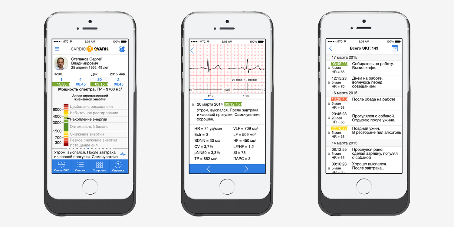 CardioQVARK — мобильный гаджет для контроля работы сердца - 3