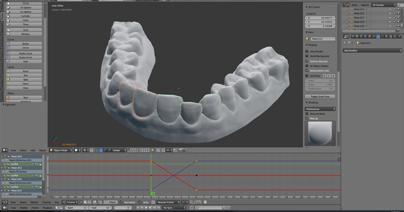 Сам себе стоматолог: американский студент исправил прикус при помощи 3D печати - 2