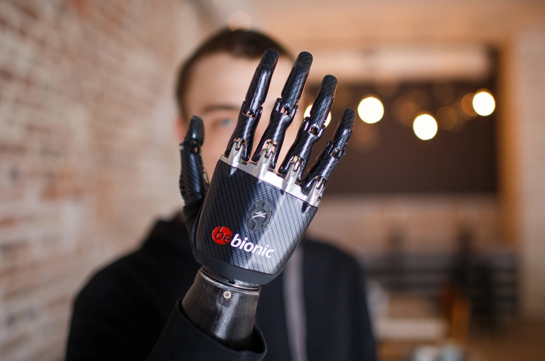 Интервью с владельцем бионических протезов BeBionic и MyoFacil: их достоинства и недостатки в повседневной жизни - 1