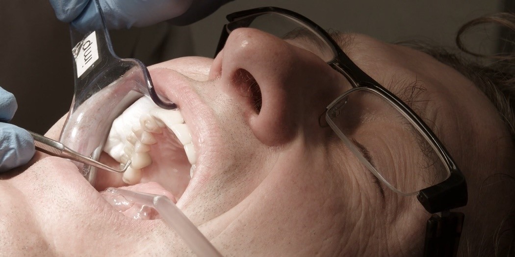 3D-печать в стоматологии на примере NextDent - 10