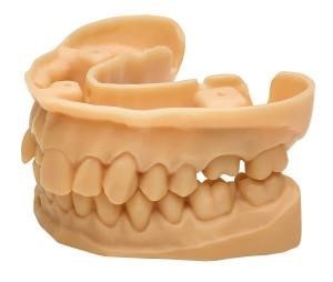 3D-печать в стоматологии на примере NextDent - 18