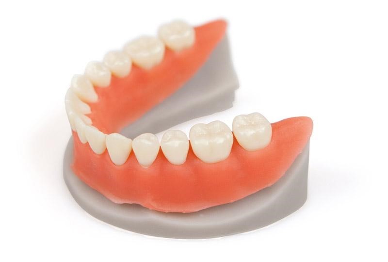 3D-печать в стоматологии на примере NextDent - 24