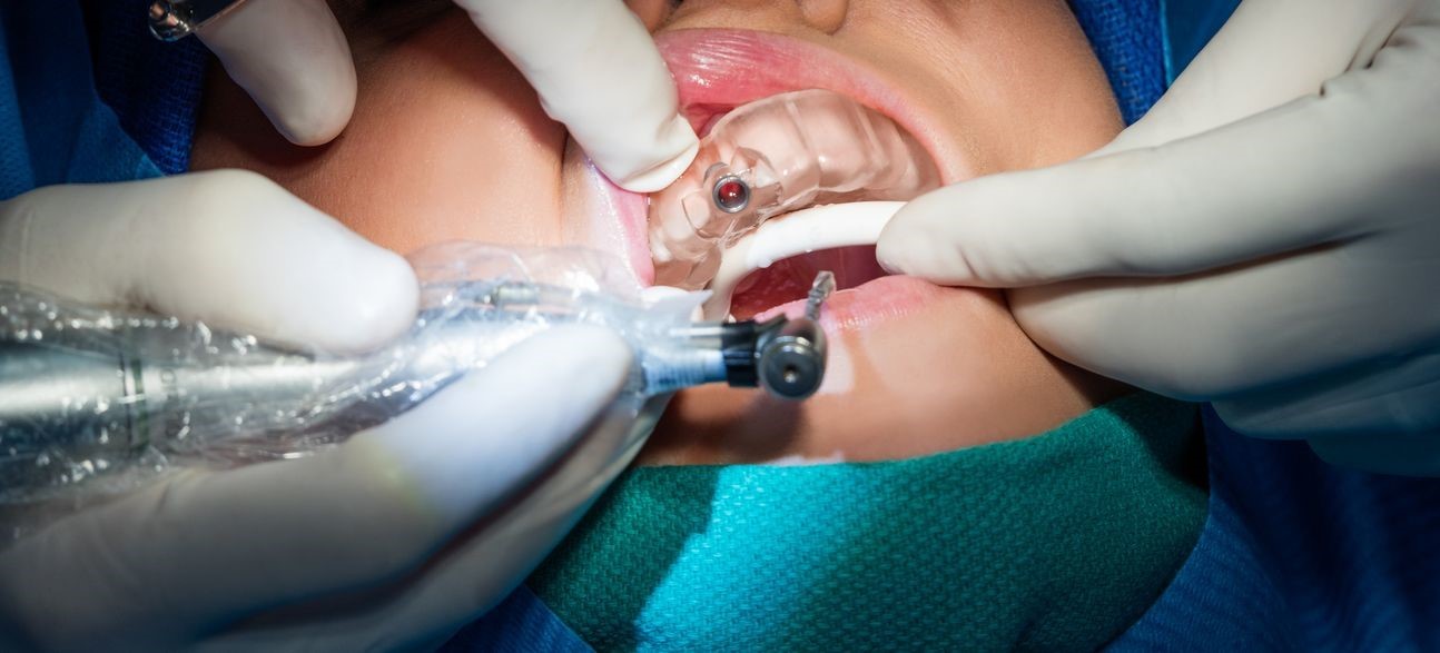 3D-печать в стоматологии на примере NextDent - 6