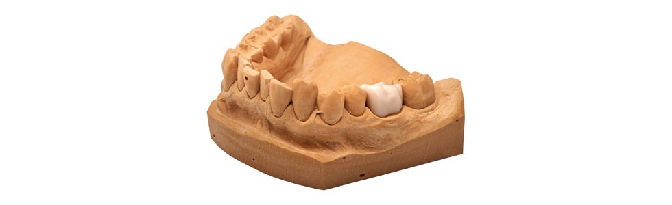 3D-печать в стоматологии на примере NextDent - 8