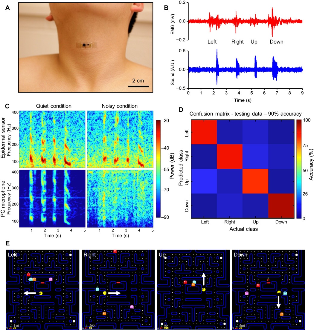 Датчик-«пластырь» может следить за работой сердца и распознавать речь - 3 image