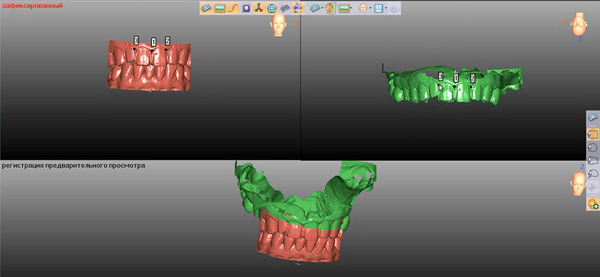 Применение 3D-технологий в стоматологии - 10