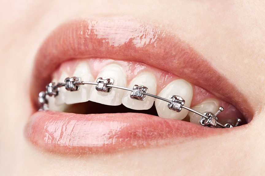 Применение 3D-технологий в стоматологии - 11