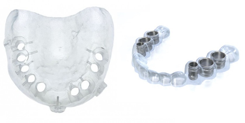 Применение 3D-технологий в стоматологии - 12