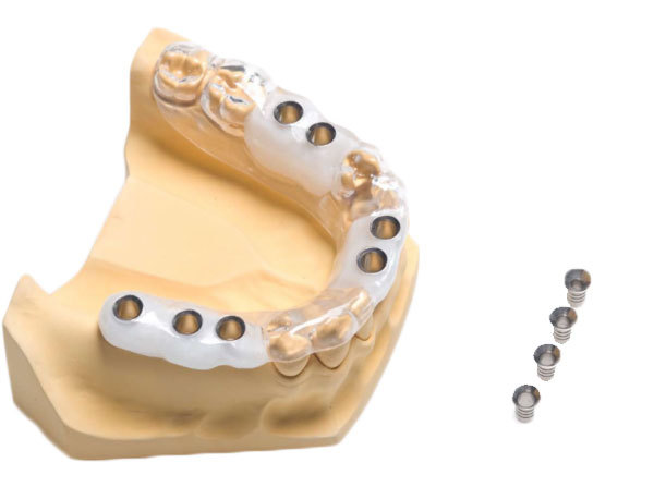 Применение 3D-технологий в стоматологии - 13