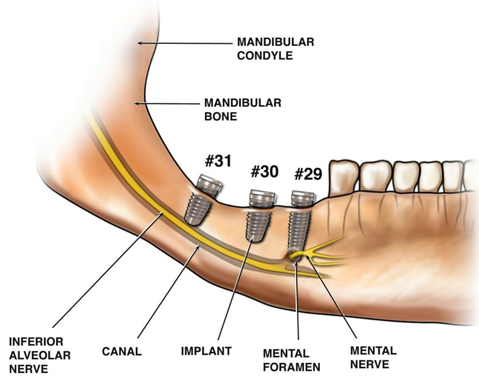 Применение 3D-технологий в стоматологии - 14