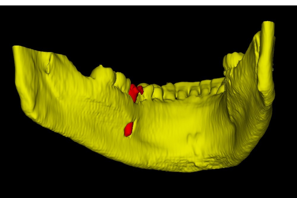 Применение 3D-технологий в стоматологии - 15