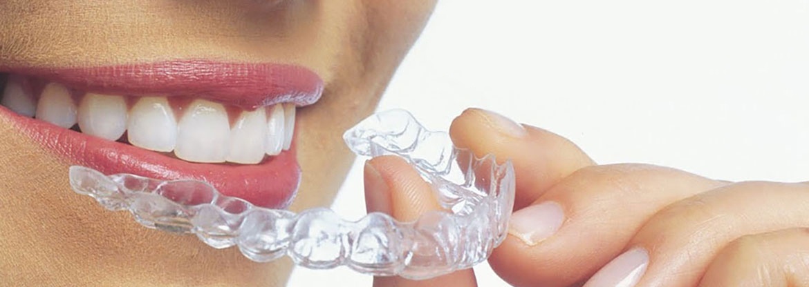 Применение 3D-технологий в стоматологии - 3