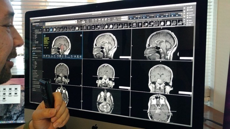 Когнитивная система IBM поможет врачам автоматизировать анализ медицинских снимков - 3