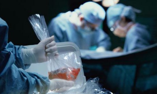 В Британии проведут первую пересадку свиных органов младенцам