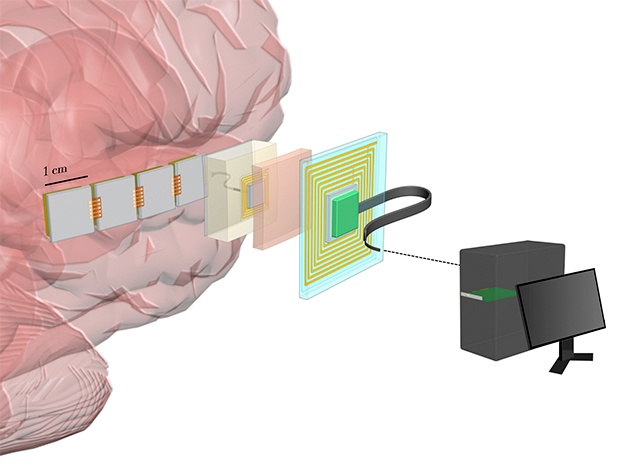 DARPA заказало разработку мозговых имплантатов высокого разрешения для интерфейса «мозг-компьютер» - 1