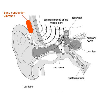 Пару слов в защиту костной проводимости - 2
