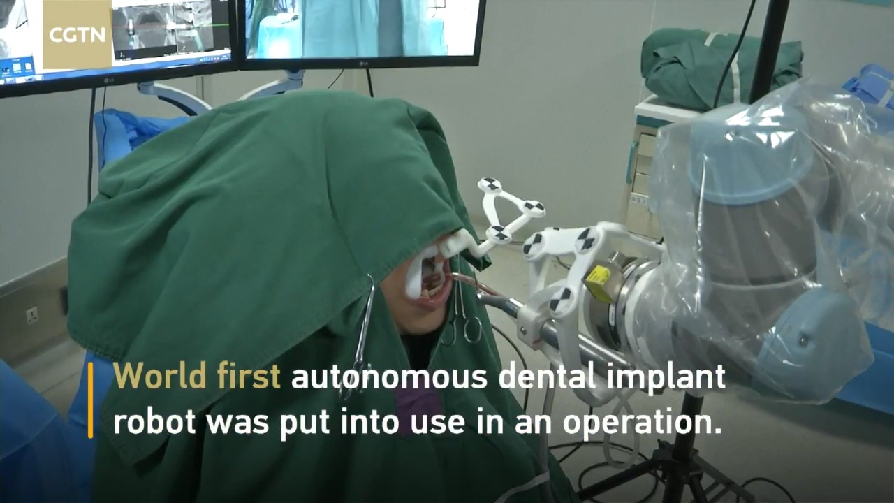 В Китае робот-дантист впервые имплантировал зуб человеку - 1