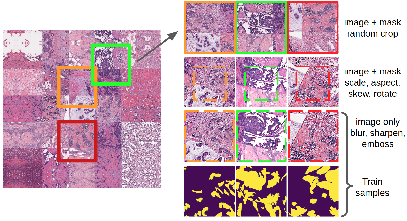 Конкурс Topcoder «Konica-Minolta Pathological Image Segmentation Challenge». Заметки участника - 3