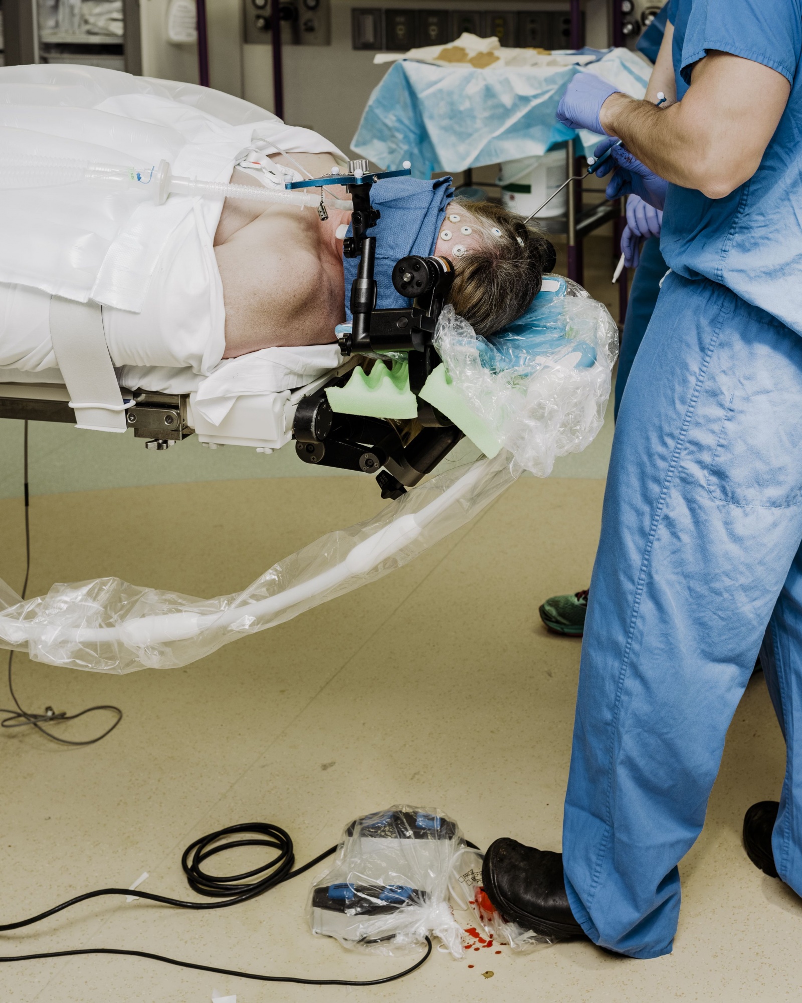 Хирург, собирающийся подключить вас к интернету через мозговой имплантат - 3