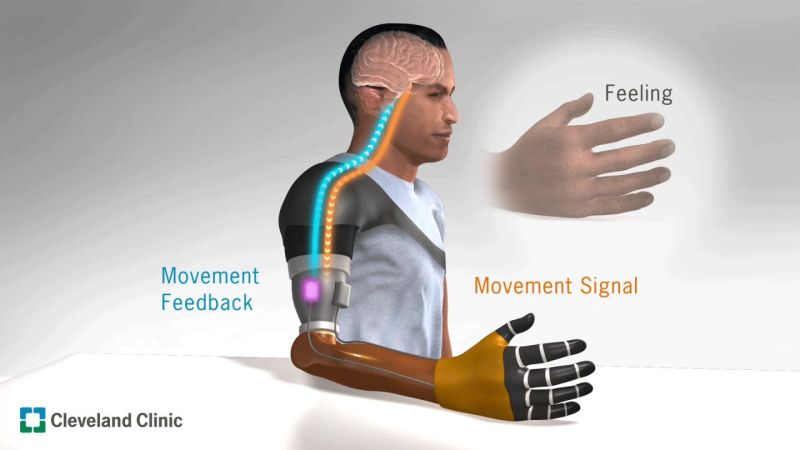 Виброотклик в протезах: новый способ улучшить контроль за бионическими конечностями - 1