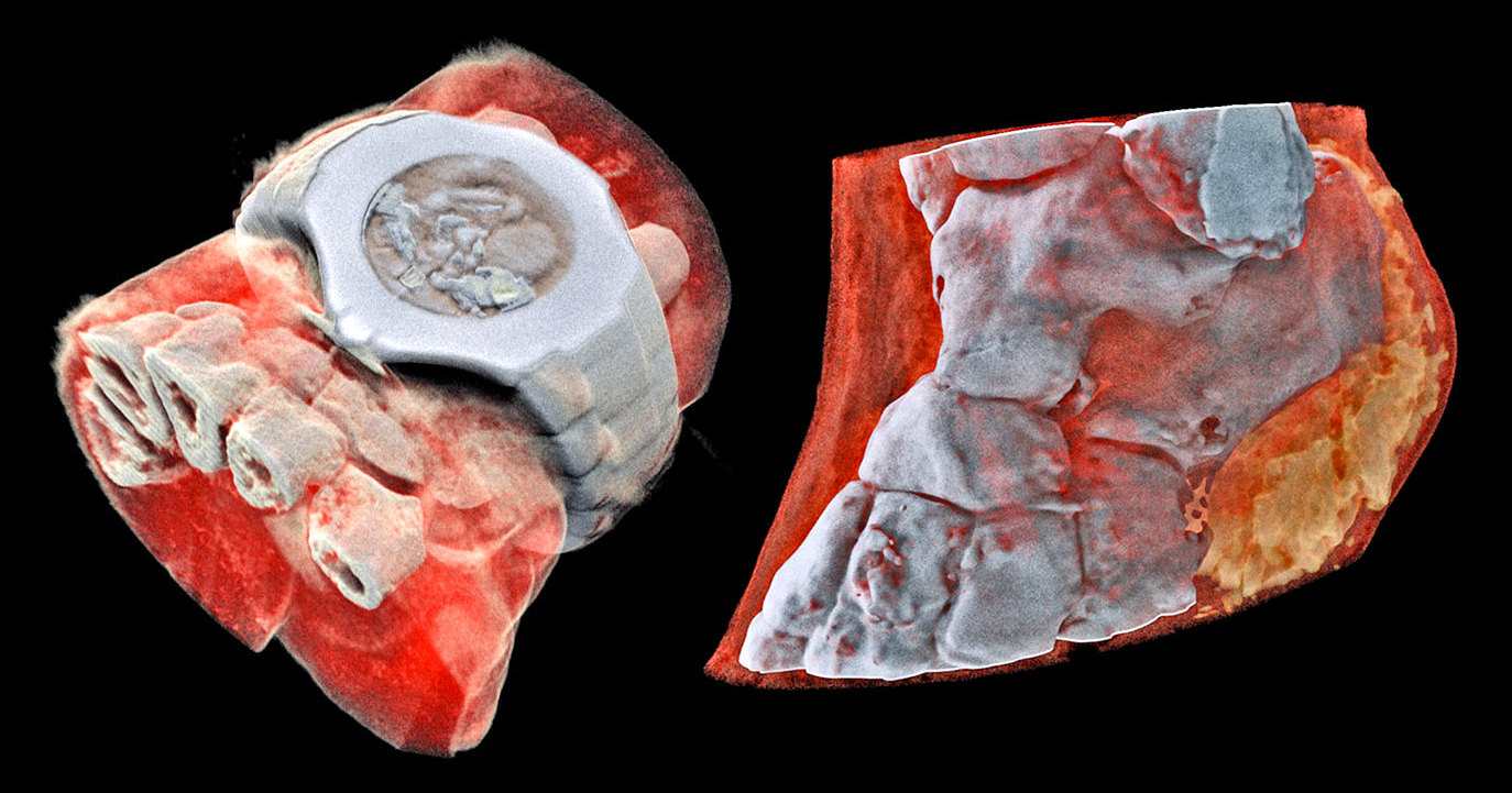 Первый в мире цветной 3D-рентген: как заглянуть внутрь организма без вскрытия