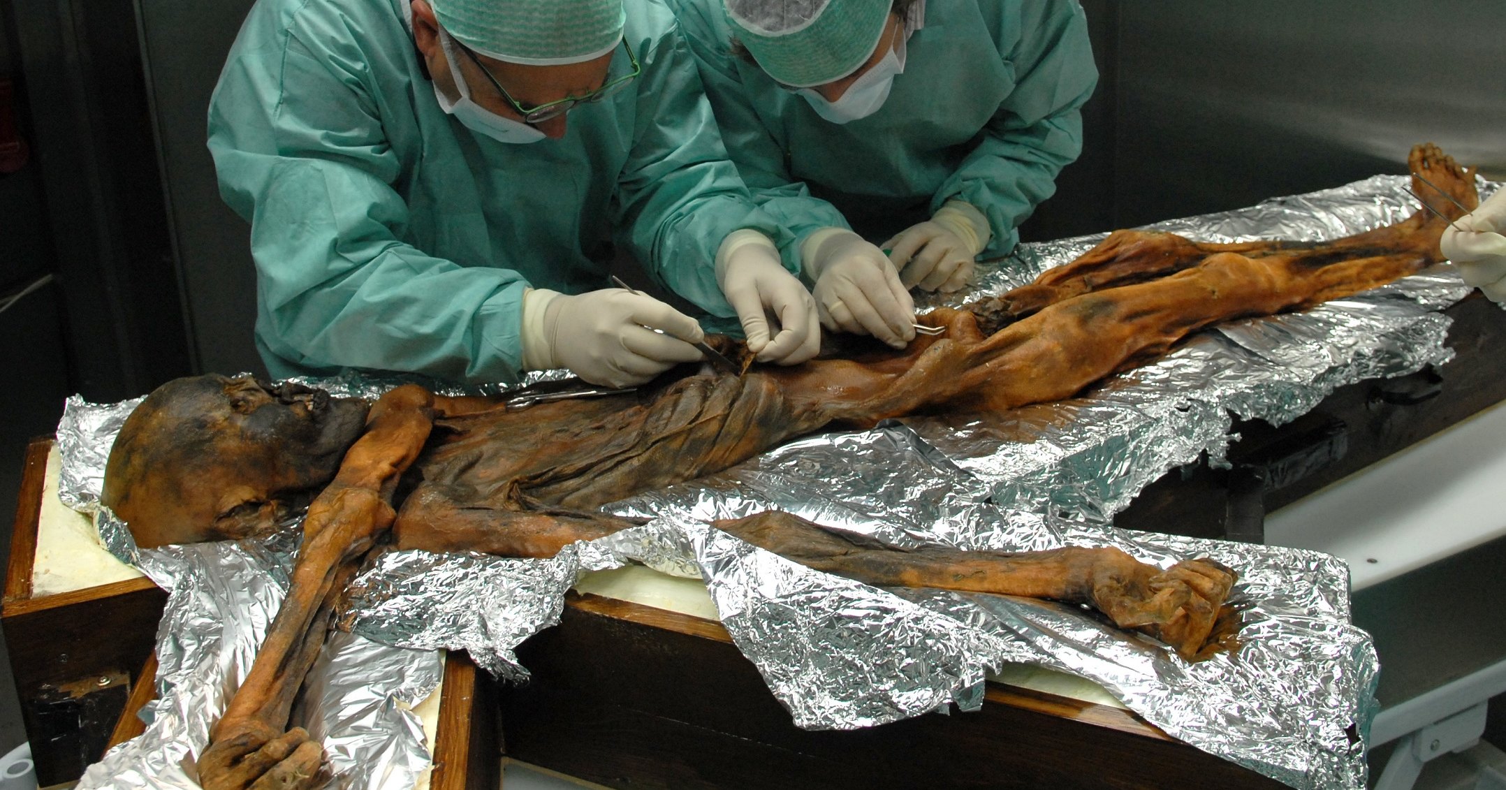 Какие загадки скрывает кишечник ледяной мумии: таинственный Эци