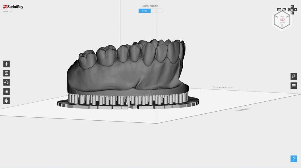 Убийца Form 2? Обзор 3D-принтера MoonRay S100 для стоматологов - 18