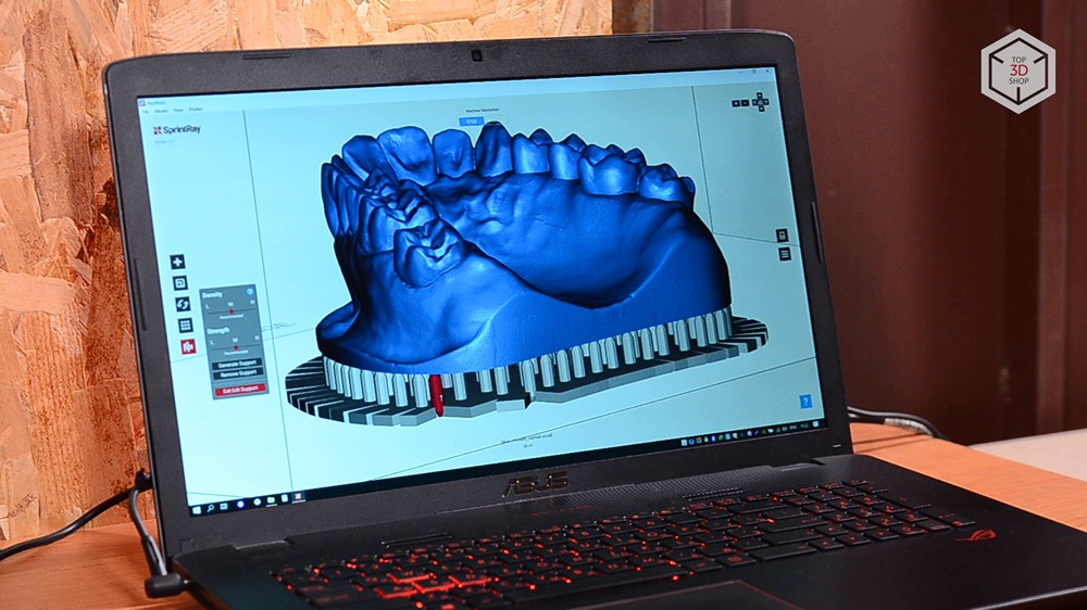 Убийца Form 2? Обзор 3D-принтера MoonRay S100 для стоматологов - 19