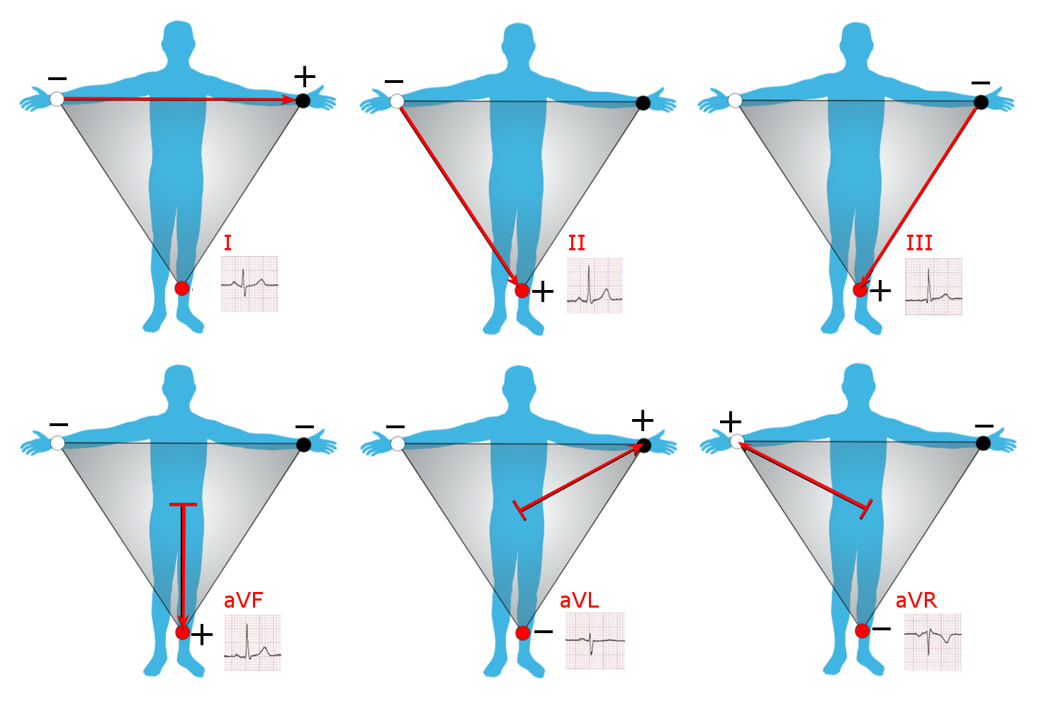 Я врач неотложной помощи, и я хочу поговорить о новой электрокардиограмме Apple Watch - 4 Я врач неотложной помощи, и я хочу поговорить о новой электрокардиограмме Apple Watch - 4