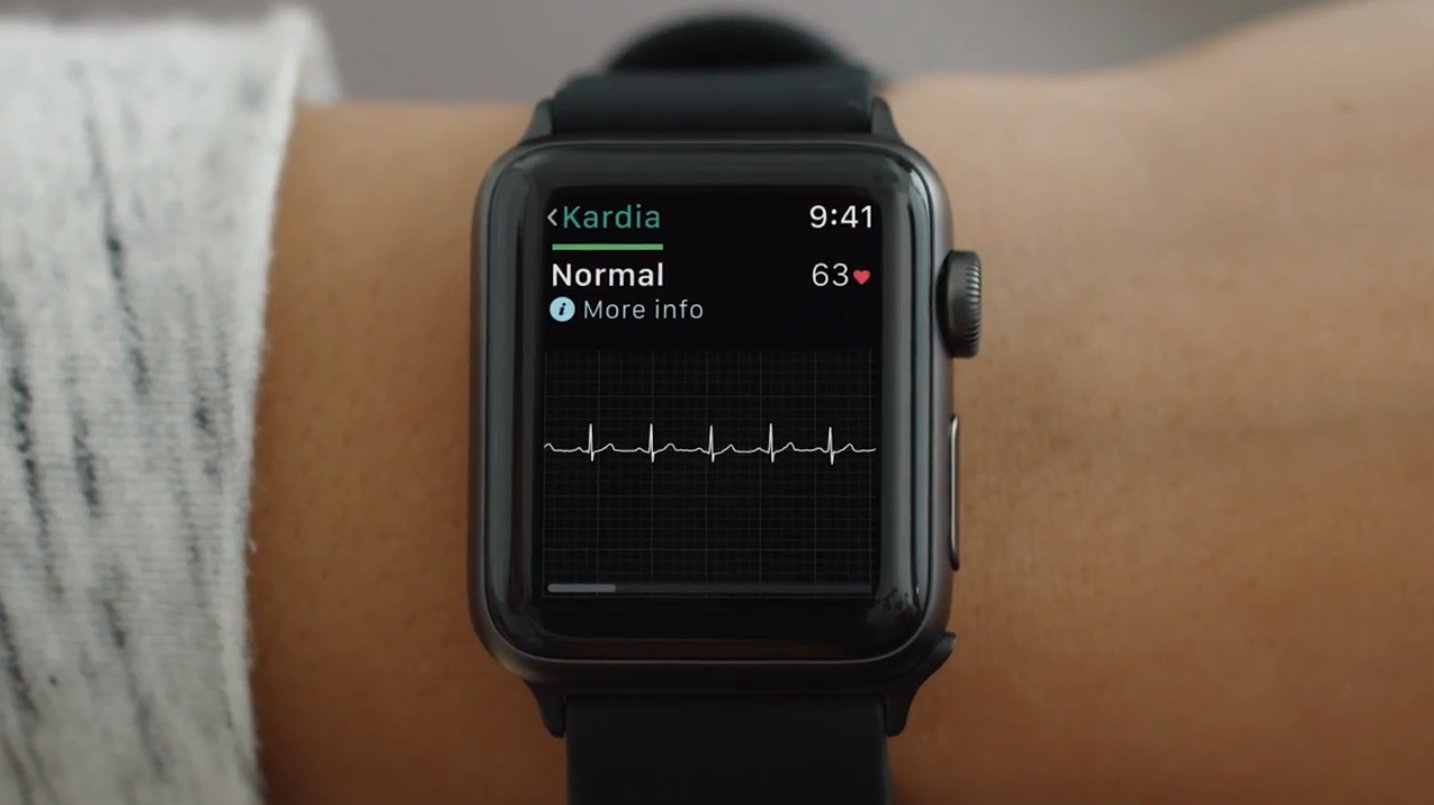 Я врач неотложной помощи, и я хочу поговорить о новой электрокардиограмме Apple Watch - 1
