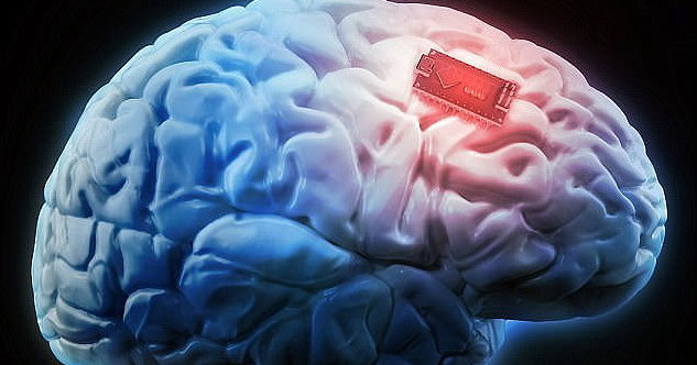 Ученые разрабатывают мозговой имплантат для перевода мыслей в речь