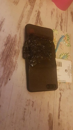 Однажды в России. Смартфон Xiaomi Note 3 загорелся прямо в кармане штанов