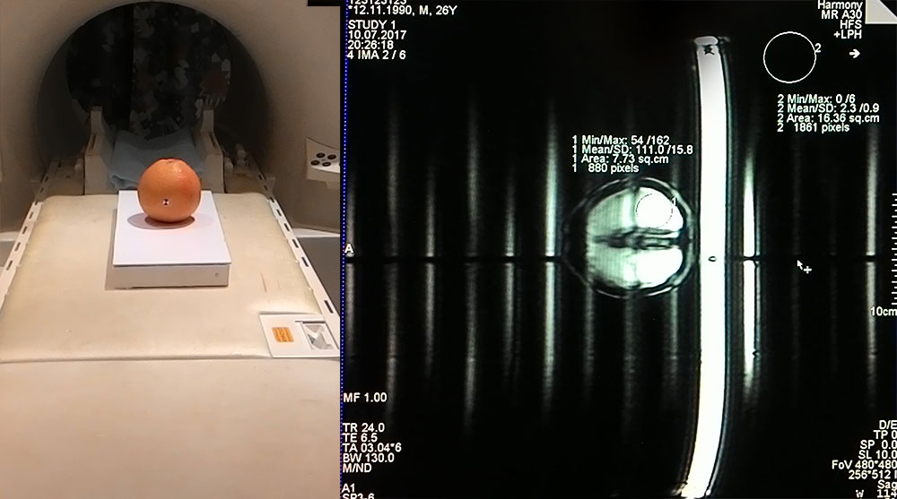 Разбираем магнитно-резонансный томограф II: Метаматериалы в МРТ - 5