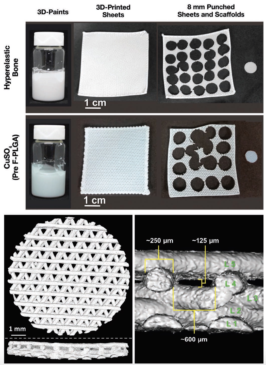 Милые кости 3D: гиперэластичный костный материал для пластики дефектов черепа - 4