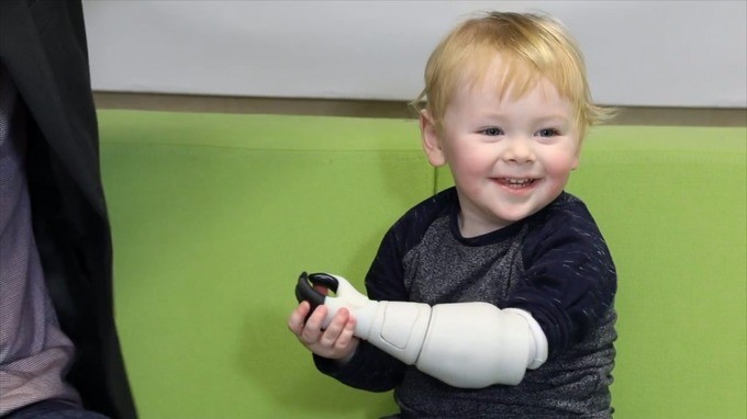 Отец создал бионический протез руки для сына с помощью 3D-принтера и X-Box - 4