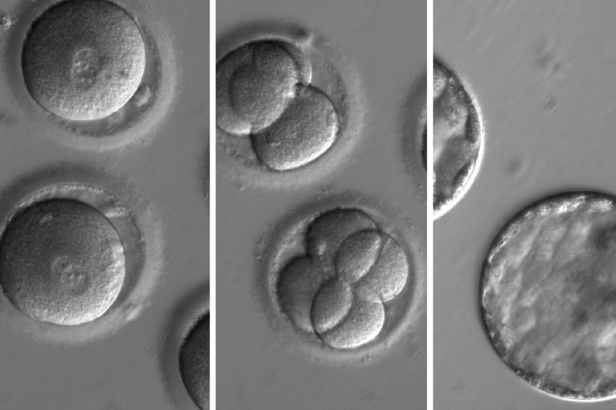Генная инженерия эмбрионов человека станет безопасной и эффективной в течение двух лет - 1