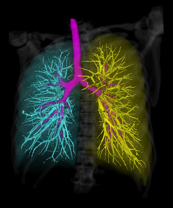 Автоматическая сегментация дыхательных органов - 1