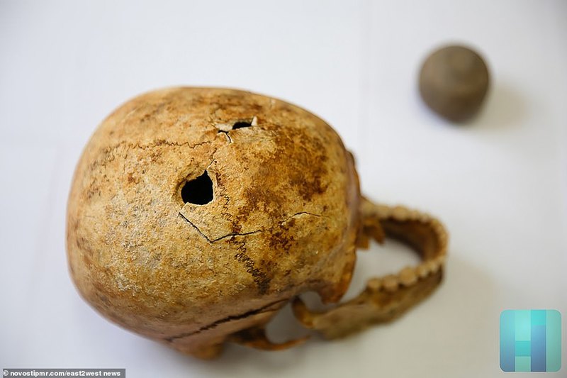 Древнему воину пробили череп, чтобы облегчить страдания